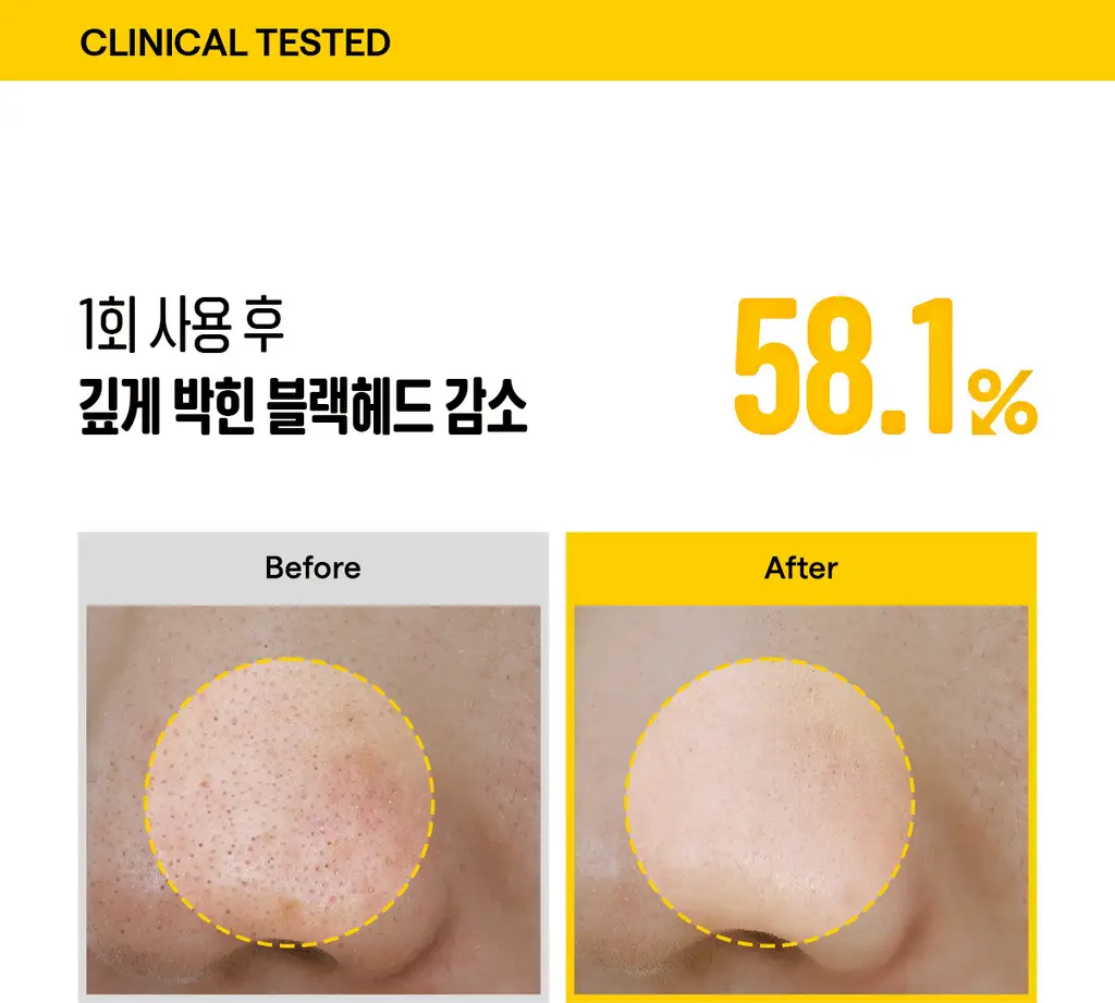 [포켓몬에디션/블랙헤드1등] 마녀공장 퓨어 소이빈 클렌징오일 200ml 2입 기획 (+미니백 키링) 상세페이지 20